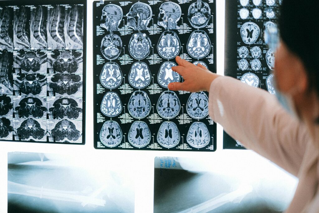 Brain Tumor Surgery